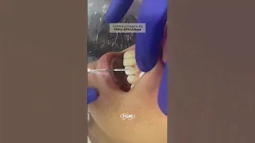 Você conhece a mágica de Vittra APS Unique?✨ #odonto #odontologia #dentista
